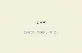 CVA SAMIR TURK, M.D.. SYMPTOMS OF STROKES AND TIA PARALYSIS NUMBNESS LANGUAGE VISUAL ATAXIA VERTIGO.