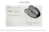 The EKG Diagrams from Dubin, Dale. 1970. Rapid Interpretation of EKG'x Third Ed. Cover Publ Co. Tampa, FL.