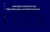 S and Femoral Head Fractures INJURIES AROUND HIP {Hip dislocations and Head fractures}