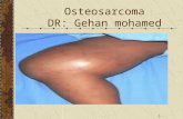 Osteosarcoma DR: Gehan mohamed 1. 10/5/20152 Osteosarcoma