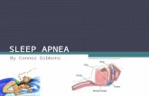 SLEEP APNEA By Connor Gibbons. What is Sleep Apnea? The stopping or halt of breathing during sleep Sleep depravation and oxygen depravation Testing is.
