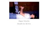 Rigor Mortis Death to 36 hrs. Livor Mortis blood settles in areas of body closest to the ground.