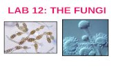 LAB 12: THE FUNGI. FUNGI: FRIEND OR FOE? Both! There are fungal pathogens and beneficial fungi Eat them Help us make bread, cheese, alcoholic beverages.
