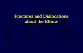 Fractures and Dislocations about the Elbow. C R I T O E 2,4,6,8,10,12
