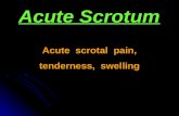 Acute Scrotum Acute scrotal pain, tenderness, swelling