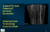 1 Superficial Femoral Artery Disease: Simulation Training Curriculum.