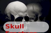 Skull Fracture. Definition Definition is a break in one or more of the eight bones that form the cranial portion of skull fracture.blunt force trauma,.