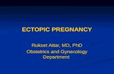 ECTOPIC PREGNANCY Rukset Attar, MD, PhD Obstetrics and Gynecology Department.