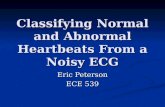 Classifying Normal and Abnormal Heartbeats From a Noisy ECG Eric Peterson ECE 539.