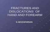 FRACTURES AND DISLOCATIONS OF HAND AND FOREARM K.MOZAFARIAN