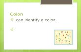 Colon  I can identify a colon.  :. Colon  I can use a colon to introduce a list.  *Must be a independent clause before the list!  A colon is needed.