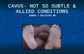 CAVUS- NOT SO SUBTLE & ALLIED CONDITIONS ARMEN S KELIKIAN MD.