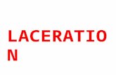 LACERATION.  Laceration are the tears or splits of skin, mucous membrane, muscle or internal organs produced by application of blunt force to broad area.