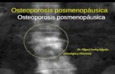 Osteoporosis posmenopáusica Dr. Miguel Sarduy Nápoles Ginecología y Obstetricia.