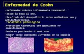 Enfermedad de Crohn Enfermedad crónica inflamatoria transmural. Desde la boca al ano. Resultado del desequilibrio entre mediadores pro y antiinflamatorios.