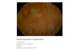 Hueso compacto longitudinal Se observan: Osteocitos en sus lagunas Periostio Teñido con H/E. Aumento 100 X.