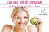 Eating with Braces Orthodontics At Hiremath Orthodontics in