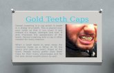 Gold Teeth Crowning