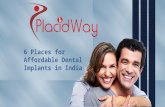6 Places for Affordable Dental Implants in India