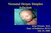 Neonatal Herpes Simplex Infection