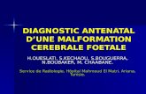 DIAGNOSTIC ANTENATAL D’UNE MALFORMATION CEREBRALE FOETALE