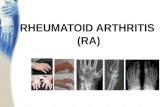 RHEUMATOID ARTHRITIS  (RA)