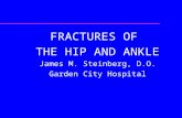 FRACTURES OF  THE HIP AND ANKLE James M. Steinberg, D.O. Garden City Hospital
