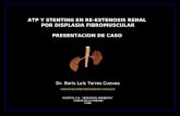 ATP Y STENTING EN RE-ESTENOSIS RENAL  POR DISPLASIA FIBROMUSCULAR PRESENTACION DE CASO