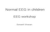 Normal EEG in children EEG workshop