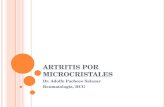 Artritis por  microcristales