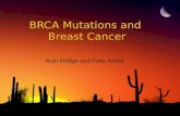 BRCA Mutations and  Breast Cancer