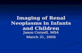 Imaging of Renal Neoplasms in Infants and Children