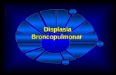 Displasia  Broncopulmonar