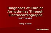 Diagnoses of Cardiac Arrhythmias Through Electrocardiographs