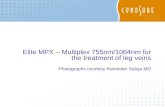Why Multiplex (MPX)?