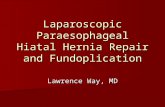 Laparoscopic Paraesophageal  Hiatal  Hernia Repair and  Fundoplication