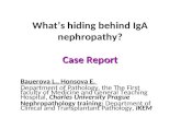 What’s hiding behind IgA nephropathy? Case Report