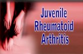 Normal knee anatomy Symptoms and pathology of juvenile rheumatoid arthritis Pain management