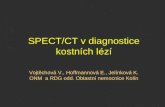 SPECT/CT v diagnostice kostních lézí Vojtěchová V., Hoffmannová E., Jelínková K.