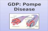 GDP: Pompe Disease