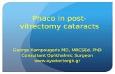 Phaco  in post- vitrectomy  cataracts