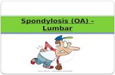 Spondylosis  (OA) - Lumbar