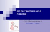 Bone Fracture and healing