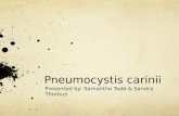 Pneumocystis  carinii