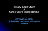 History and Future of Aortic Valve Implantation