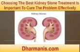 Choosing The Best Kidney Stone Treatment Is Important To Cure The Problem Effectively