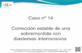14.- Corrección estable de una sobremordida con diastemas interincisivos - Rafael Gallardo Galdón