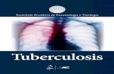 Conde | Tuberculosis