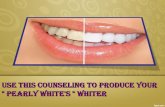 Use This Counseling To Produce Your " pearly white's " Whiter