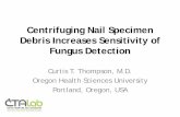 Curtis Thompson Nail Fungus Presentation